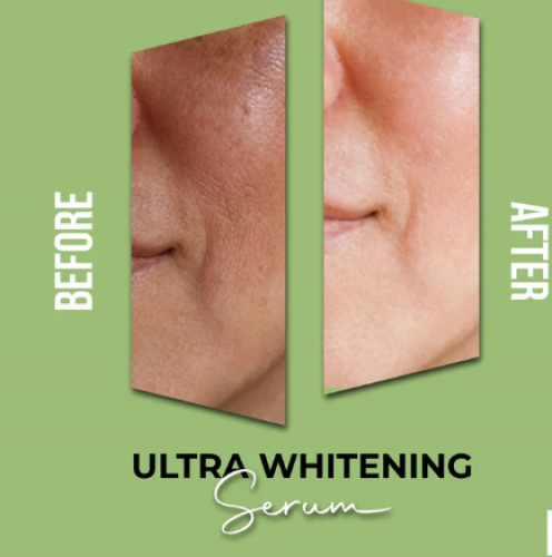 Ultra whitening serum