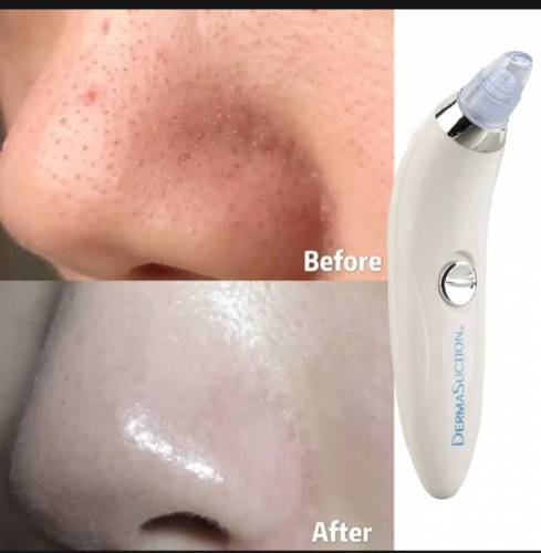 Black head remover machine l black and white head remover l pore clean