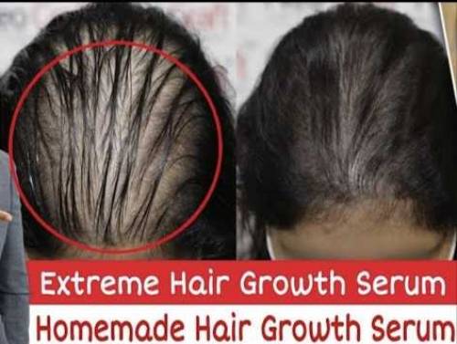 Haider Hair Growth Netural Serum 