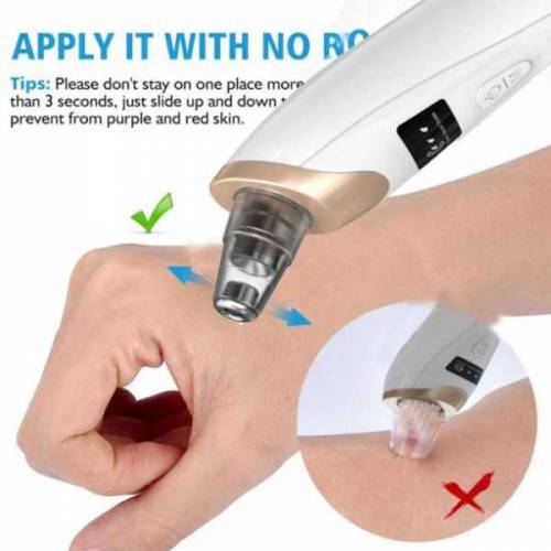Derma Suction Blackheads Remover Device Blackhead Extractor (cell Oper