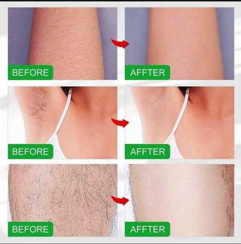 Hair remover spray for men and women