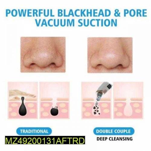 portable black head pore cleaner 