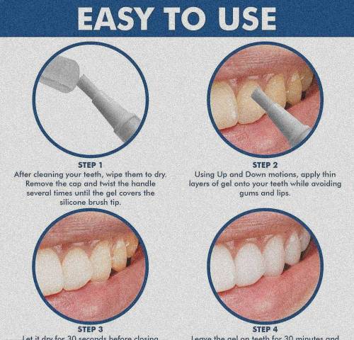 Instant Teeth Whitening Pen