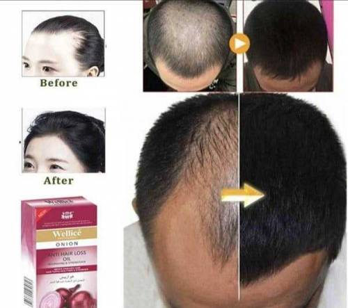 Wellice Anti-Hair Loss Onion Hair Oil
