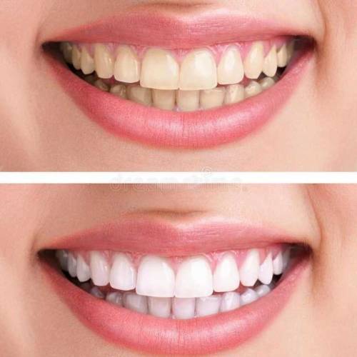 instant Teeth Whitening Pen 