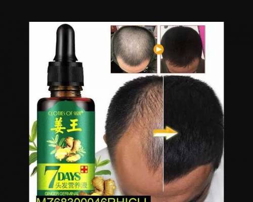 Hair growth Oil in 7 Day