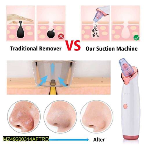 Blackhead Remover Vacuum Pore Cleaner