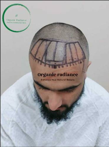 Organic RadianceHair Repair & Hair Re_Growth Oil Available