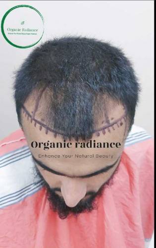 Organic RadianceHair Repair & Hair Re_Growth Oil Available