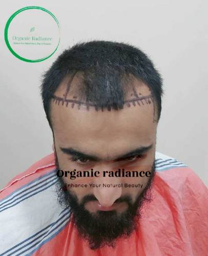 Organic RadianceHair Repair & Hair Re_Growth Oil Available