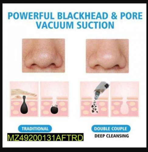 Portable Blackhead Removal