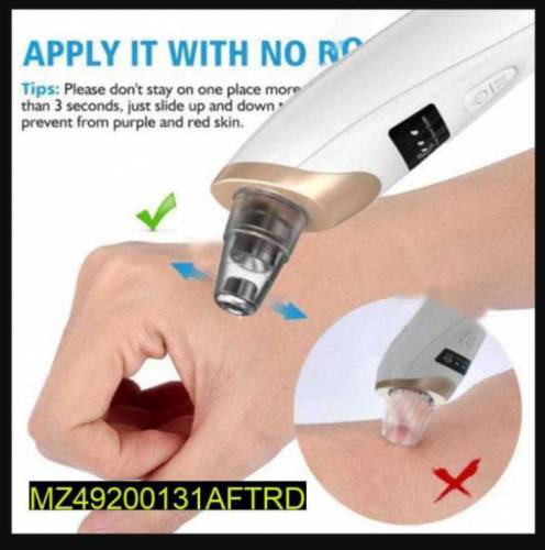 Portable Blackhead Removal