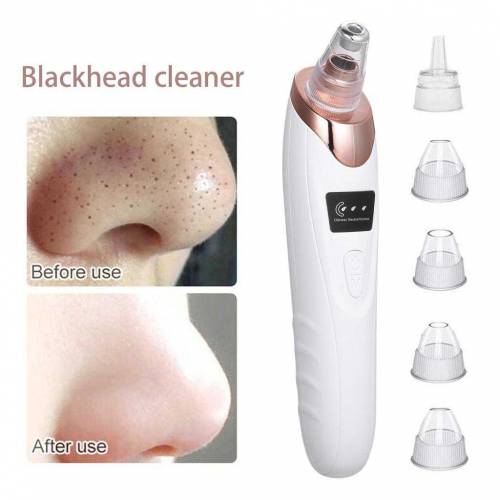 Sale Sale,blackheads remover