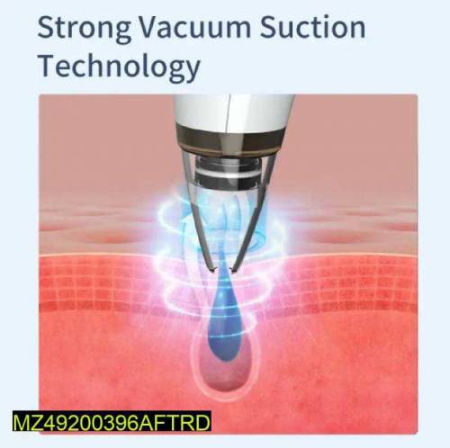 Vacuum Blackhead Remover Machine