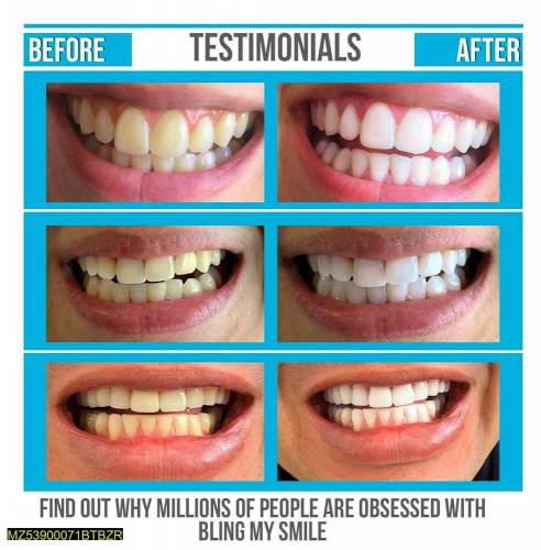 teeth whitening 