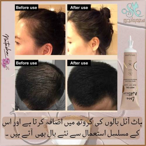 LOVE NATURE HOT OIL 