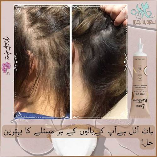 LOVE NATURE HOT OIL 