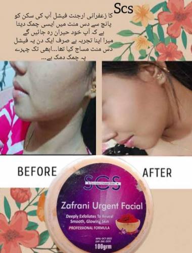 ZAFRANI urgent facial 