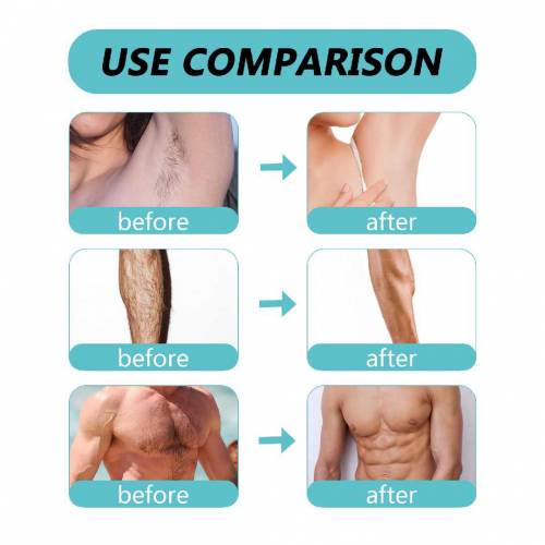 Ecrin Body Hair Removal Spray 150 ml 