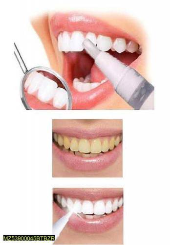 Teeth whitening Pen
