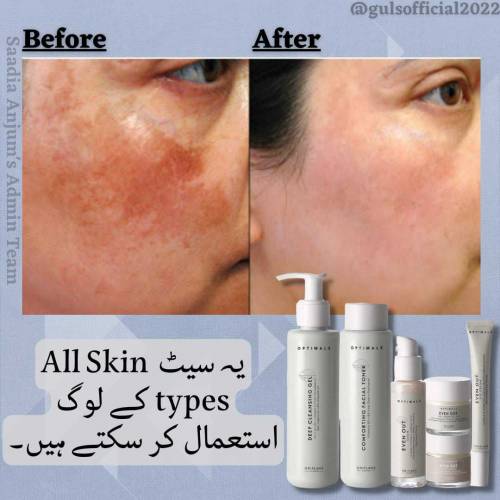 pigmentation treatment 