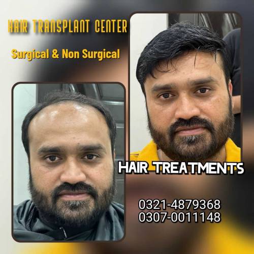 hair patch , hair wig , hair unit , hair extention , hair cap , topi
