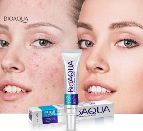 acne scars removal rejuvenation cream 