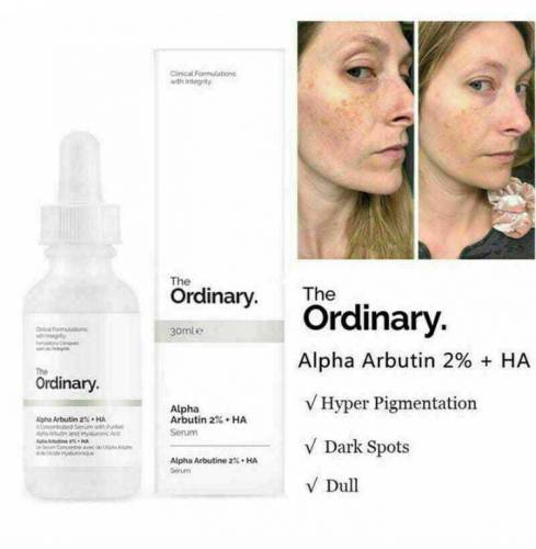 ordinary serum