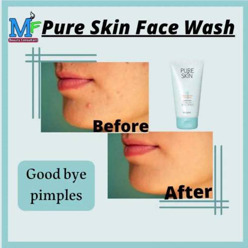pure skin face wash for pimple issues 