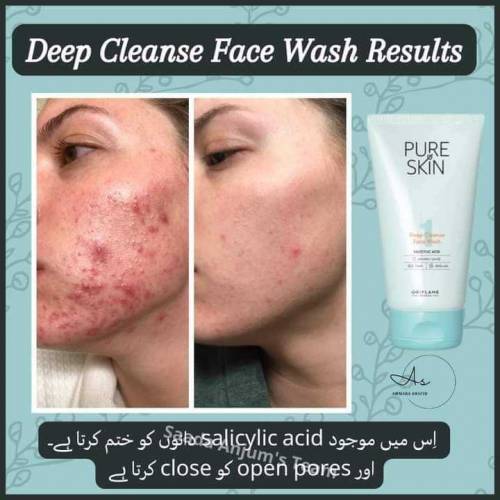 pure skin face wash for pimple issues 