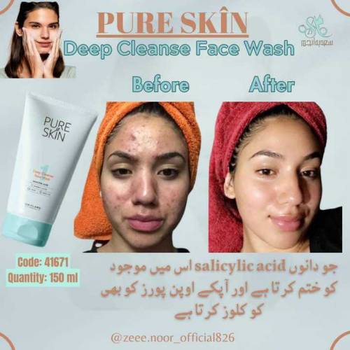 pure skin face wash for pimple issues 