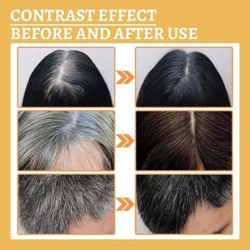 Havelyn Hair Food Oil | Derma Roller | Anti-greying Hair Serum