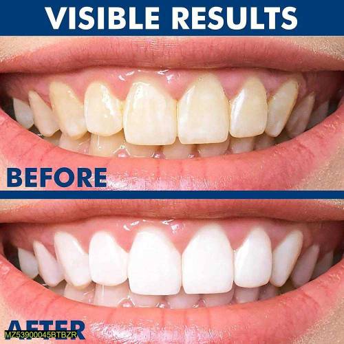 Teeth whitening paste 