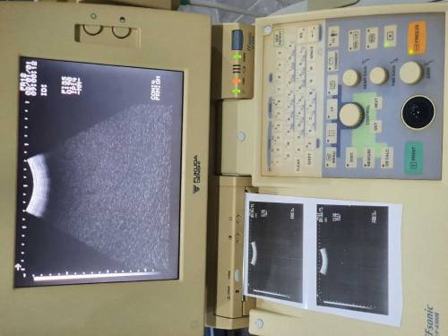Ultrasound Machine (Fukuda Denshi FFsonic UF-4300R)