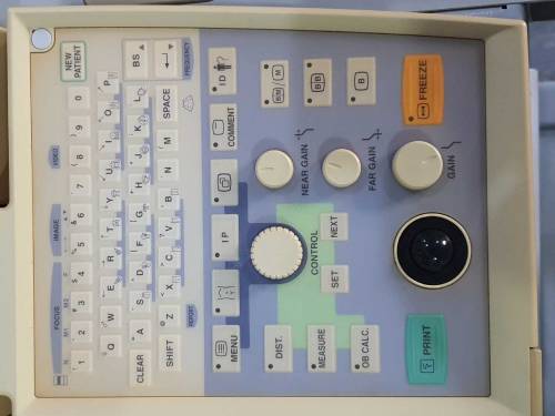 Ultrasound Machine (Fukuda Denshi FFsonic UF-4300R)