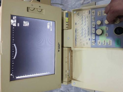 Ultrasound Machine (Fukuda Denshi FFsonic UF-4300R)