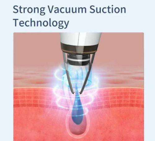 Vacuum Black Head Remover Machine 