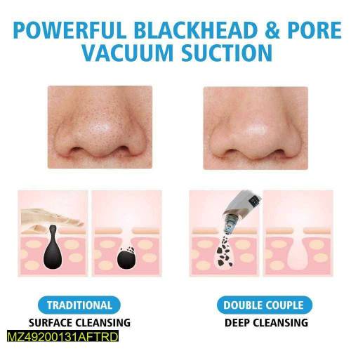 Vacuum Black Head Remover Machine 