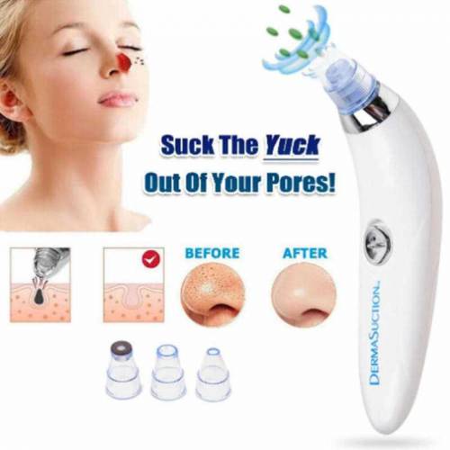 Derma Suction Blackhead Removal Machine 4 in 1 Black Head Remover Mach