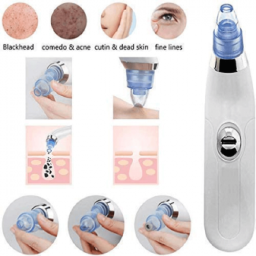 Derma Suction Blackhead Removal Machine 4 in 1 Black Head Remover Mach
