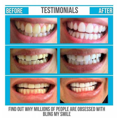 teeth whitening charcoal powder 