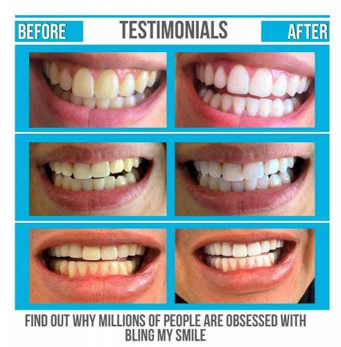 SeiBella-Activated Teeth Whitening Powder 100g