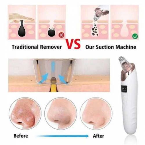 Blackhead Removing Tools 