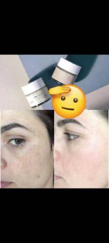 for all skin problem one solution pimple pigmentation dullness 