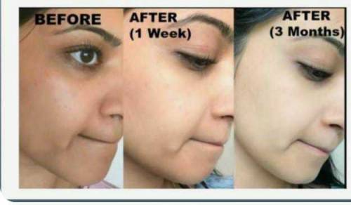 essential Face wash for Glowing waiting titing your skin 