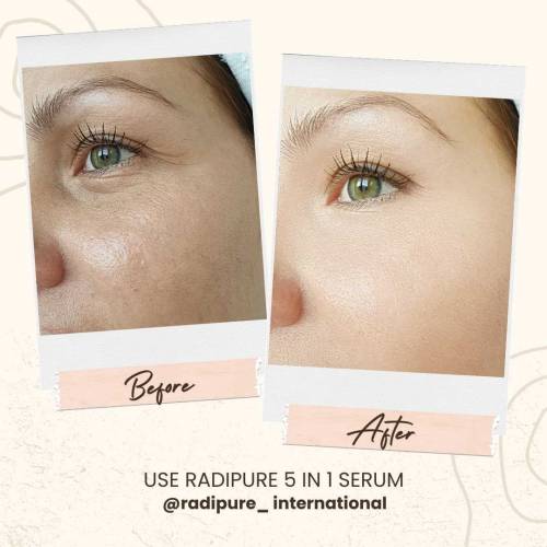 Radipure whitening serum 