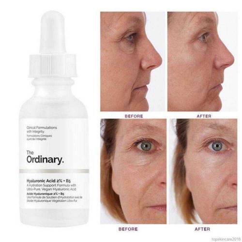 Hyaluronic Acid 2% + B5 Face Serum